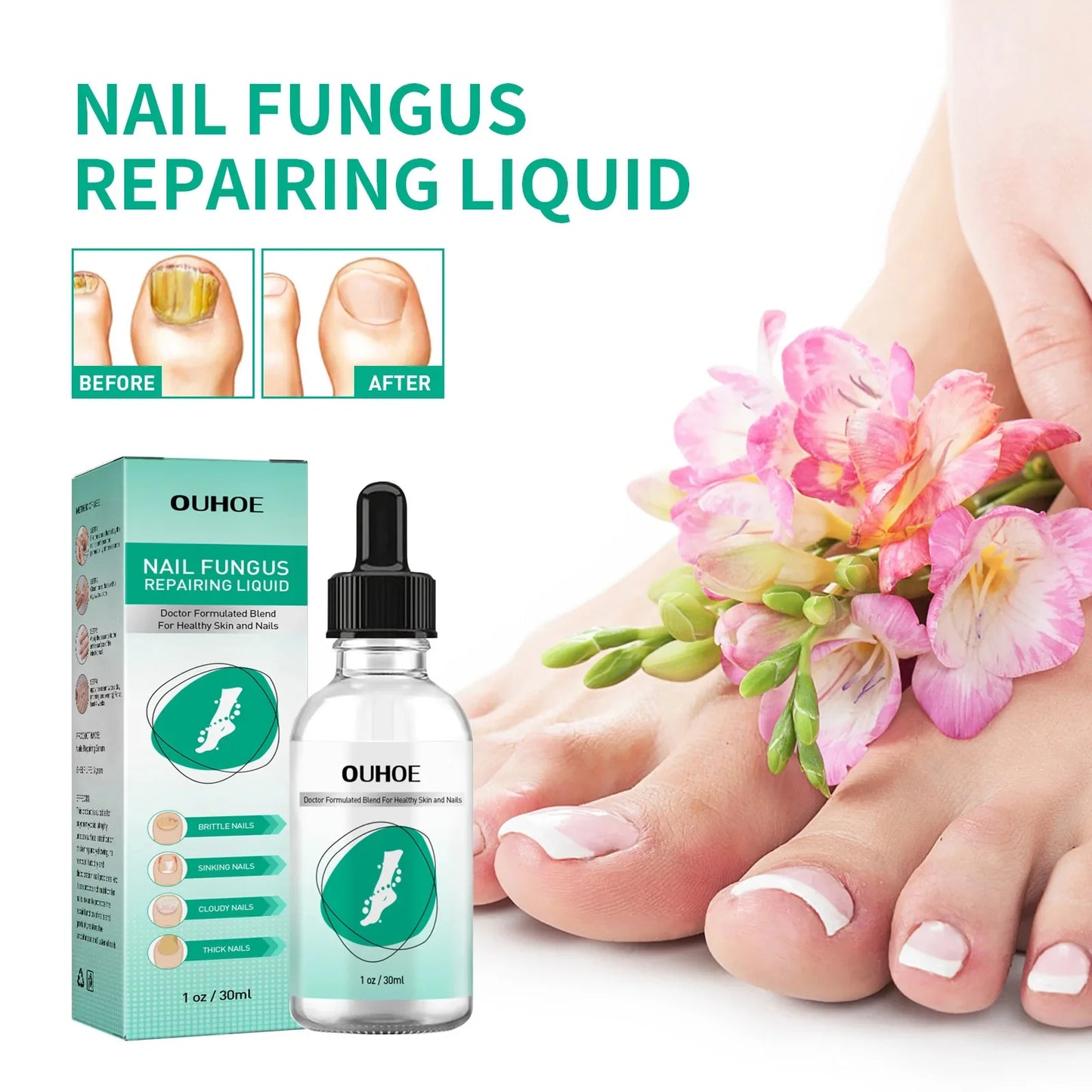 Herbal Nail Fungus Treatment Gel 30ml Short Eye Catching Title for Foot Care Protection Skin Repair Cream Nail Polish Repair Products