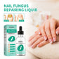 Herbal Nail Fungus Treatment Gel 30ml Short Eye Catching Title for Foot Care Protection Skin Repair Cream Nail Polish Repair Products