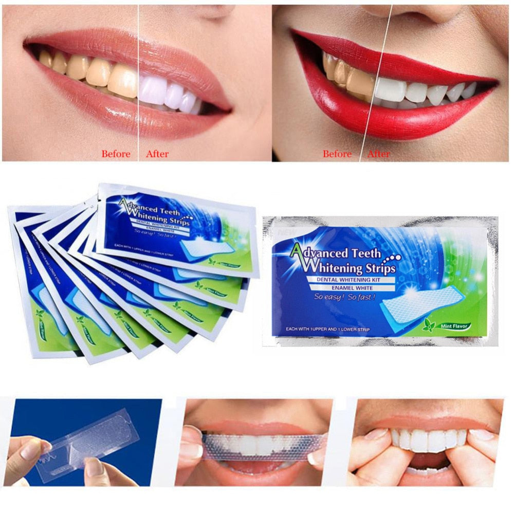 White Gel Teeth Whitening Tooth Bleaching Whiter Teeth Whitening Strips - Executive-Skincare