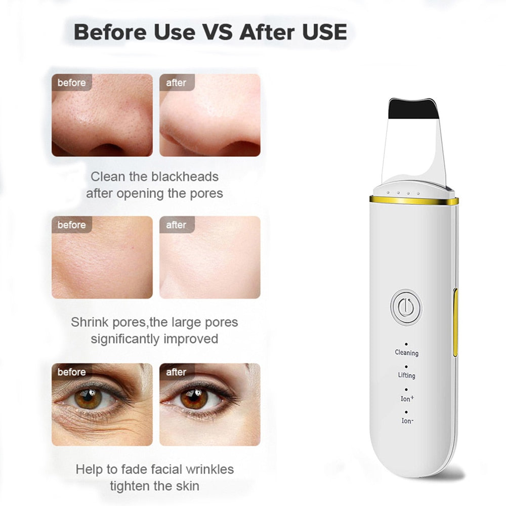 Beauty Ultrasonic Skin Scrubber USB Plug Facial Cleaner Tools - Executive-Skincare