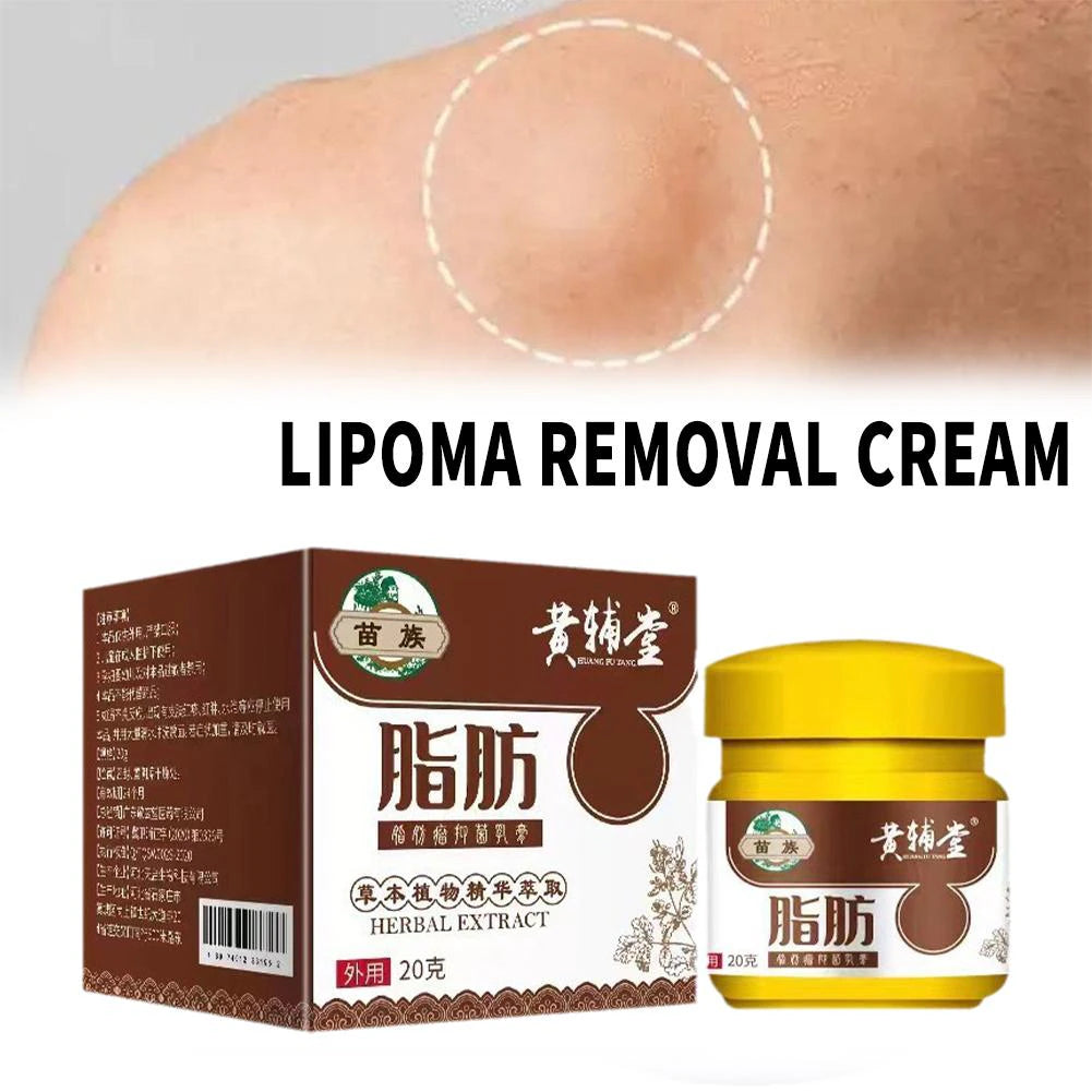 Lipoma Removal Cream 20G Relief Pain Treat Skin Swelling Lipolysis Cellulite Remover Ointment Lipolysis Fat Lump Body Care