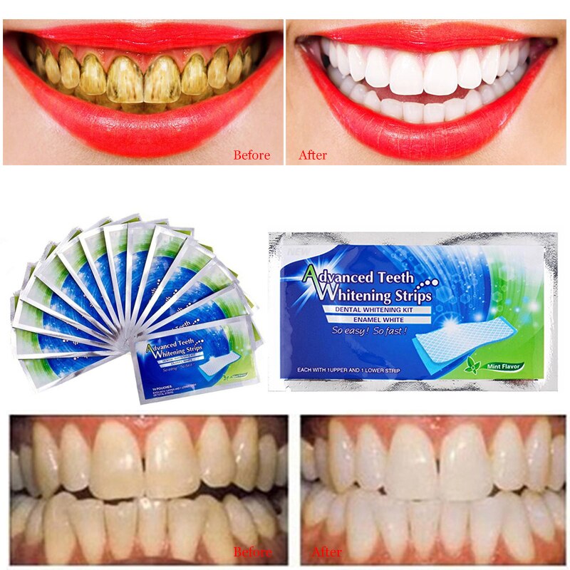 White Gel Teeth Whitening Tooth Bleaching Whiter Teeth Whitening Strips - Executive-Skincare