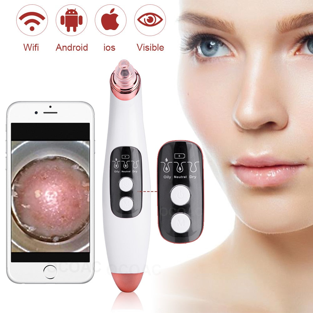 Visible Camera Blackhead Remover Face Deep Nose Cleaner Pore Acne Pimple Removal Vacuum Suction Facial Beauty Clean Skin Tool - Executive-Skincare