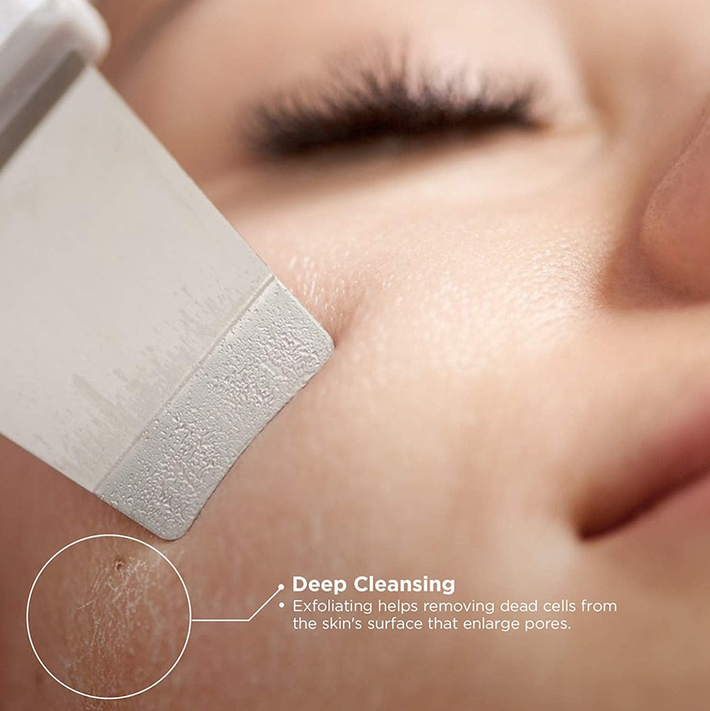 Ultrasonic Face Skin Scrubber - Executive-Skincare