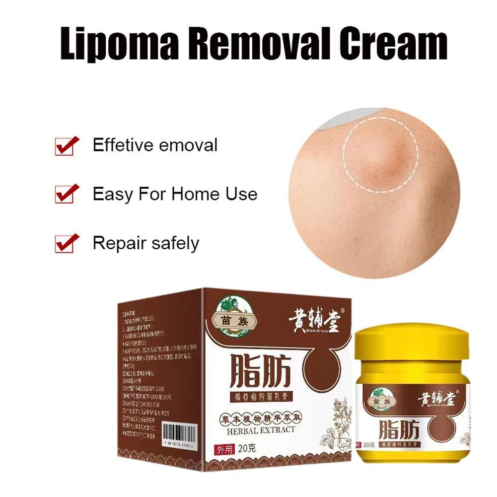 Lipoma Removal Cream 20G Relief Pain Treat Skin Swelling Lipolysis Cellulite Remover Ointment Lipolysis Fat Lump Body Care