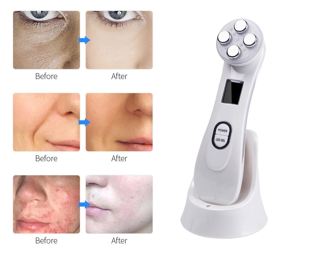 Skin Care Face Massager - Executive-Skincare