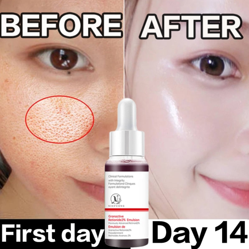 Pore Minimizer Serum For Face Pore Facial Pore Narrowing Serum Pore Contraction Tightens Essence Shrink Pores Serum - Executive-Skincare