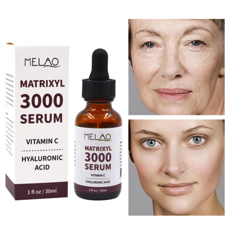 MATRIXYL 3000 Face Serum Vitamin C Hyaluronic Acid Reduce Sun Spots Wrinkles Anti-Aging Lifting Shape Korean Beauty Health Care - Executive-Skincare