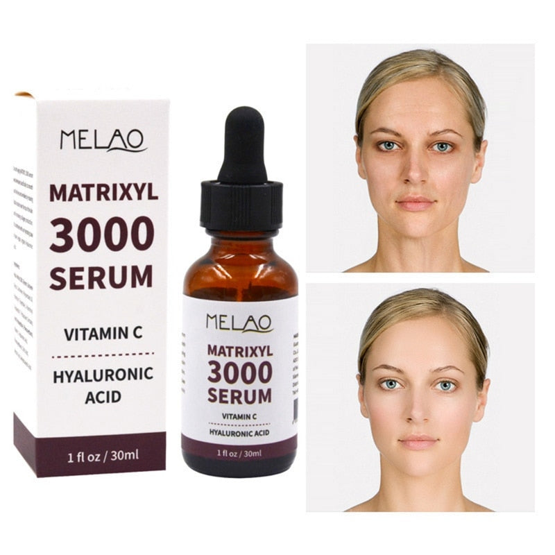 MATRIXYL 3000 Face Serum Vitamin C Hyaluronic Acid Reduce Sun Spots Wrinkles Anti-Aging Lifting Shape Korean Beauty Health Care - Executive-Skincare