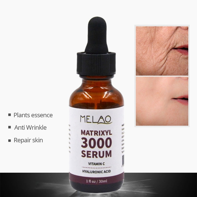 MATRIXYL 3000 Face Serum Vitamin C Hyaluronic Acid Reduce Sun Spots Wrinkles Anti-Aging Lifting Shape Korean Beauty Health Care - Executive-Skincare