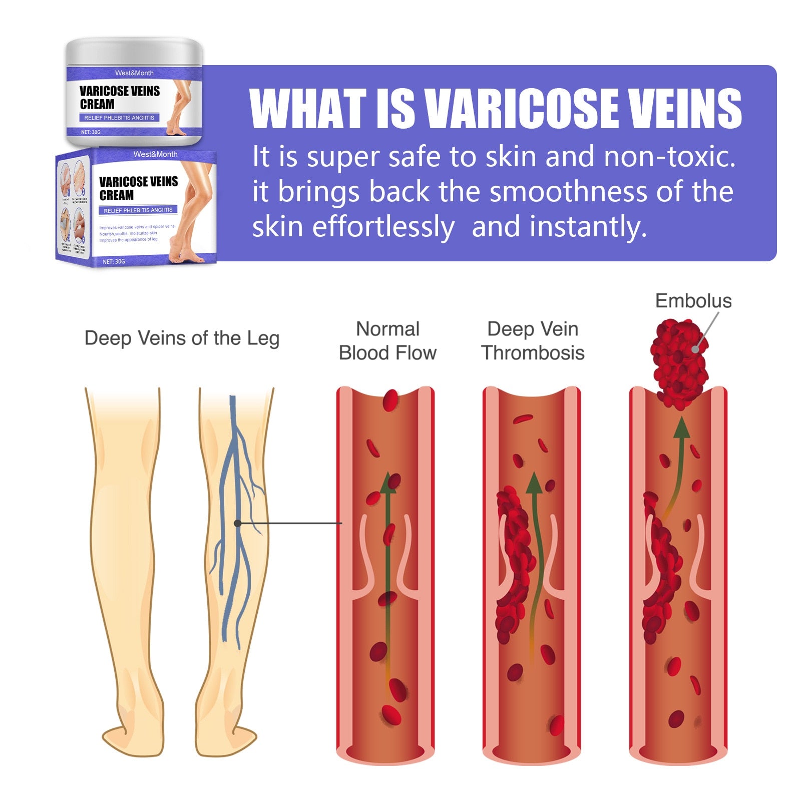 Effective Varicose Veins Relief Cream Relieve Vasculitis Phlebitis Spider Pain Treatment Ointment Medical Plaster Body Care 30g - Executive-Skincare