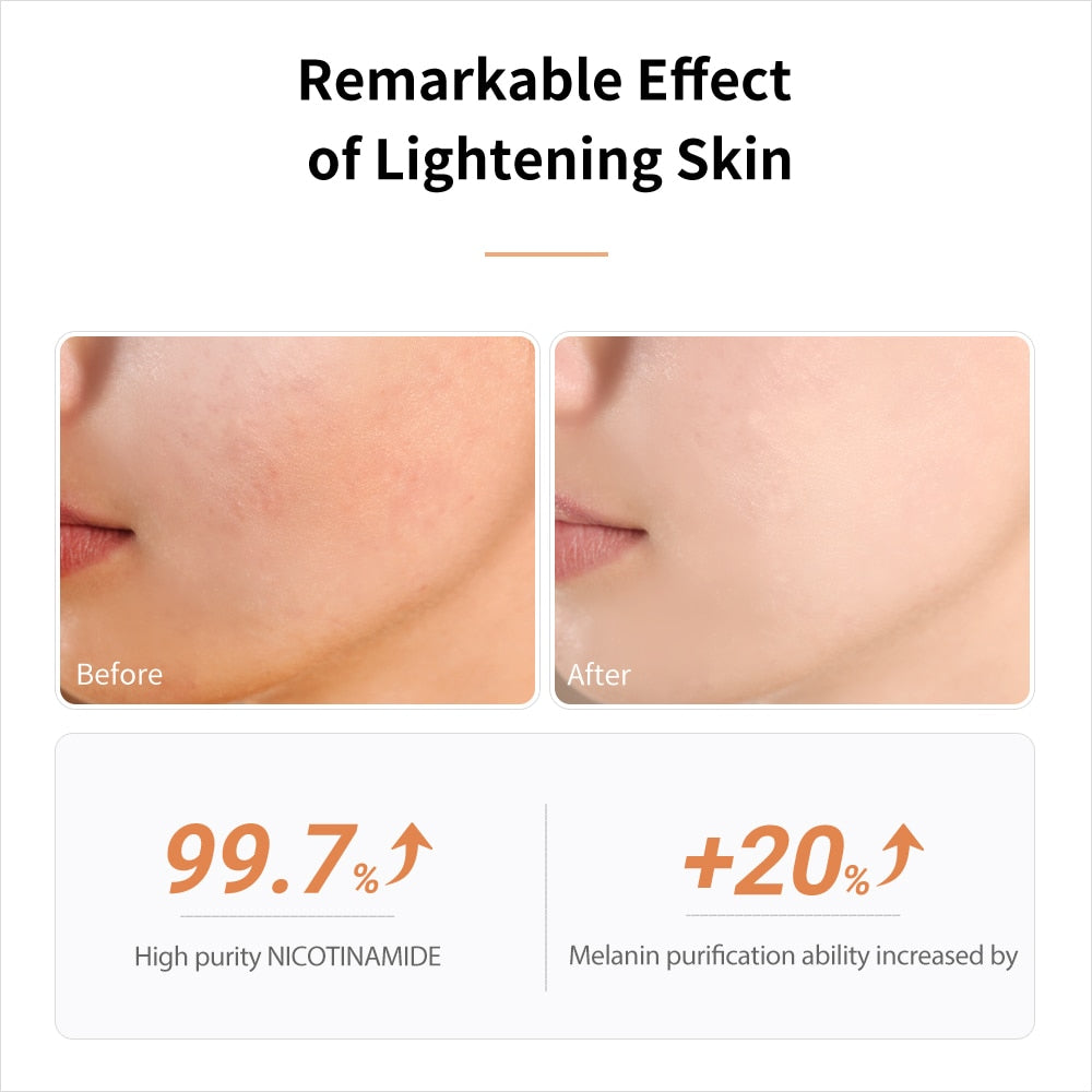 LANBENA Niacinamide Face Serum Facial Whitening Anti Aging Wrinkle Hyaluronic Acid Moisturizing Shrink Pores Serum Skin Essence - Executive-Skincare