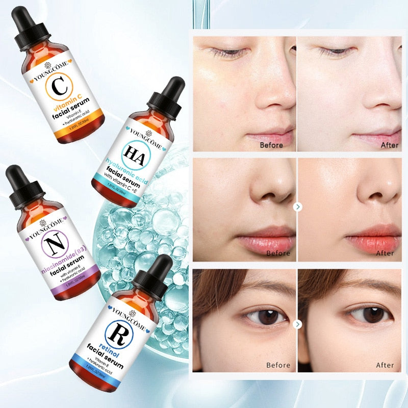 YOUNGCOME 30ml 50ml Vitamin C Retinol Facial Serum Whitening Brightening Moisturizing Lighten Spots Hyaluronic Acid Eyes Essence - Executive-Skincare