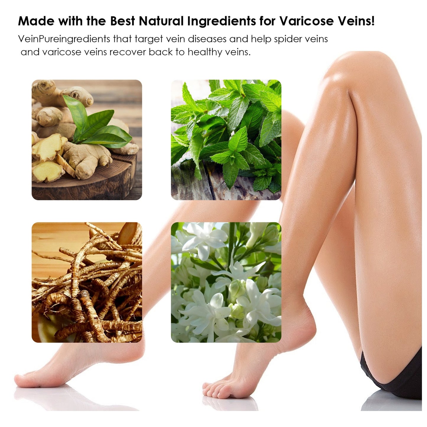 Varicose Vein Relief Spray Relieve Vasculitis Phlebitis Spider Leg Pain Treatment Ointment Medical Sooth Moisturizing Body Care - Executive-Skincare