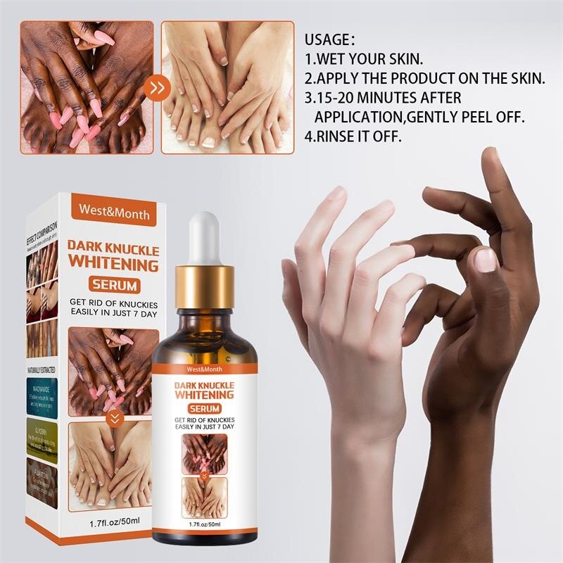 50g Body Whitening Serum Oil Joint De-blackening Lighten Melanin Knee Ankle Corner Brighten Corrector Skin Rejuvenation Bleach - Executive Quality Store