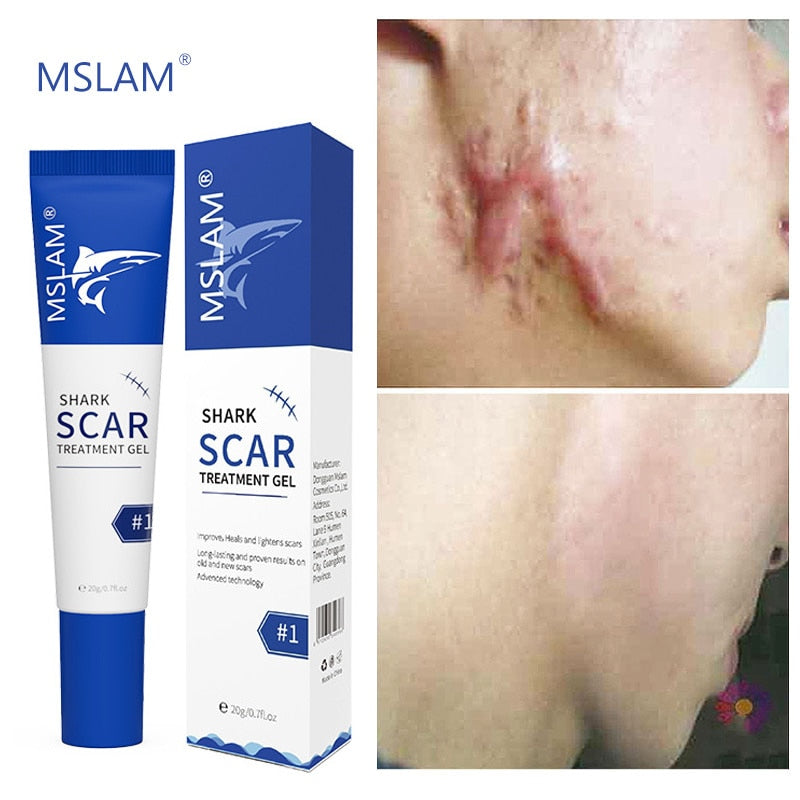 Scar Removal Cream Gel Remove Acne Spots Treatment Stretch Marks Burn Surgical Scar Repair Cream Smoothing Whitening Skin Beauty - Executive Quality Store