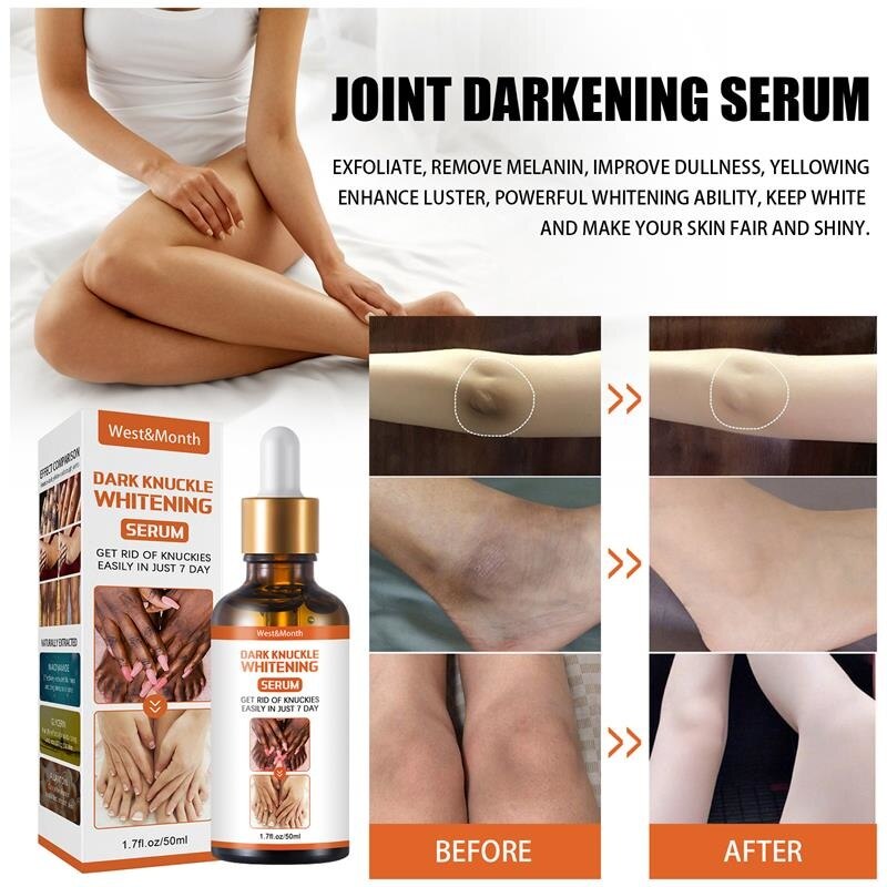 50g Body Whitening Serum Oil Joint De-blackening Lighten Melanin Knee Ankle Corner Brighten Corrector Skin Rejuvenation Bleach - Executive Quality Store