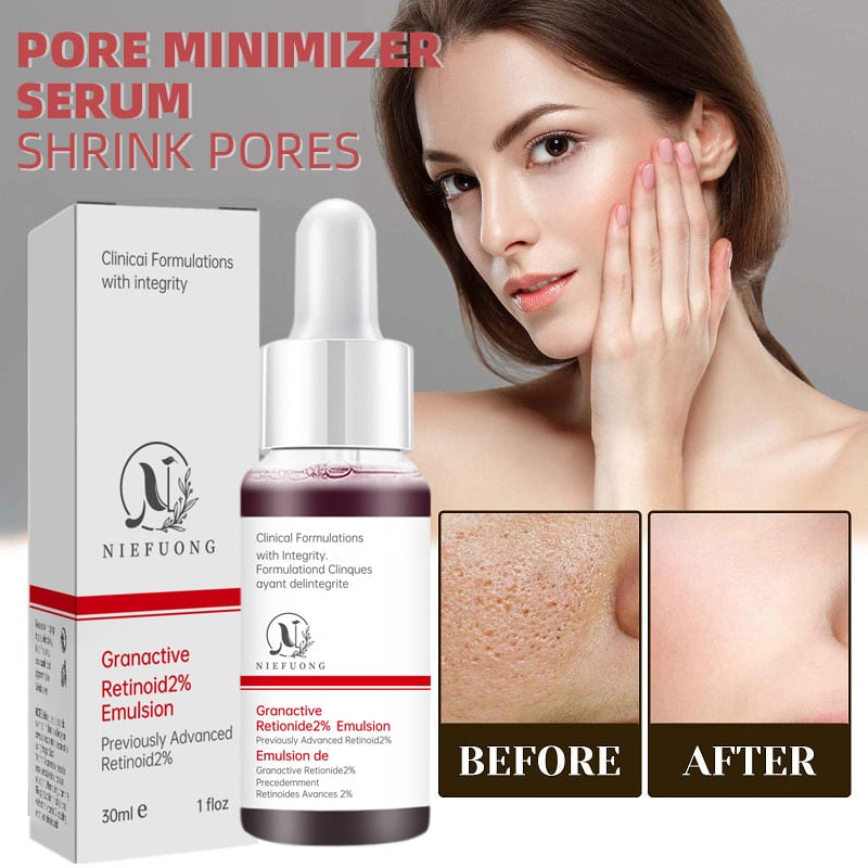 Pore Minimizer Serum For Face Pore Facial Pore Narrowing Serum Pore Contraction Tightens Essence Shrink Pores Serum - Executive-Skincare