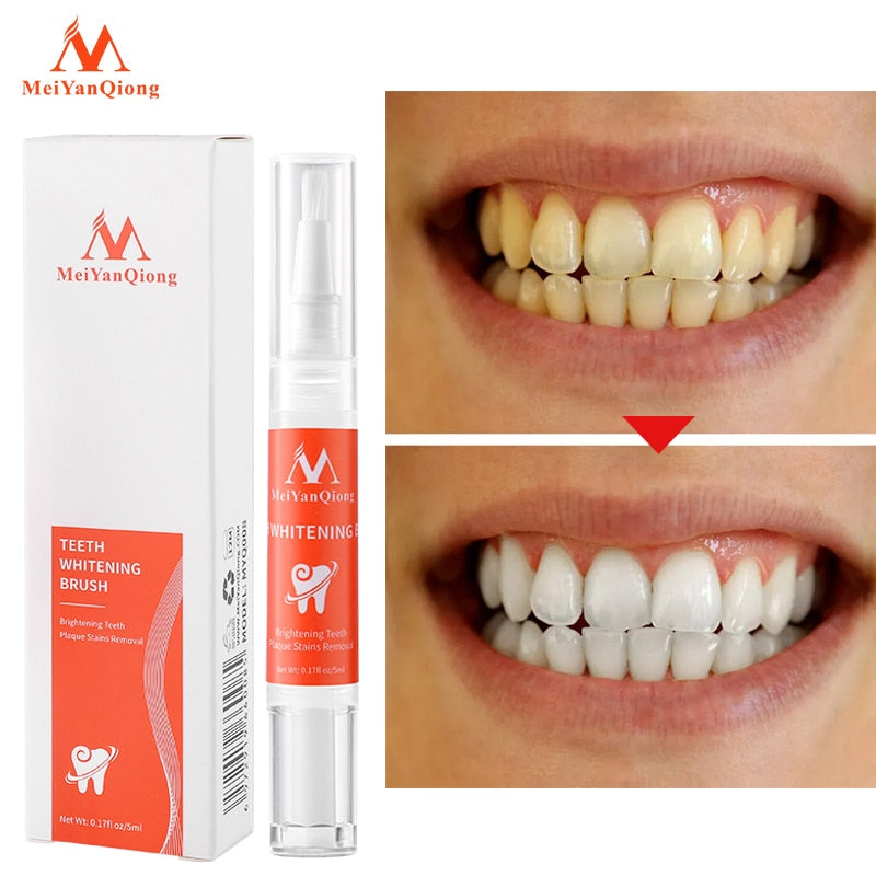 New Teeth Whitening Pen Tooth Gel Whitener Bleach Remove Stains Instant Smile Teeth Whitening Kit Cleaning Serum Beauty Health - Executive-Skincare