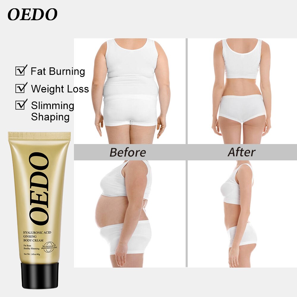 OEDO Hyaluronic Acid Ginseng Slimming Cream Reduce Cellulite Lose Weight Burning Fat Slimming Cream Health Care Burning Creams - Executive-Skincare