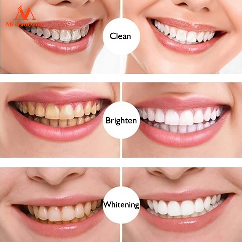 New Teeth Whitening Pen Tooth Gel Whitener Bleach Remove Stains Instant Smile Teeth Whitening Kit Cleaning Serum Beauty Health - Executive-Skincare