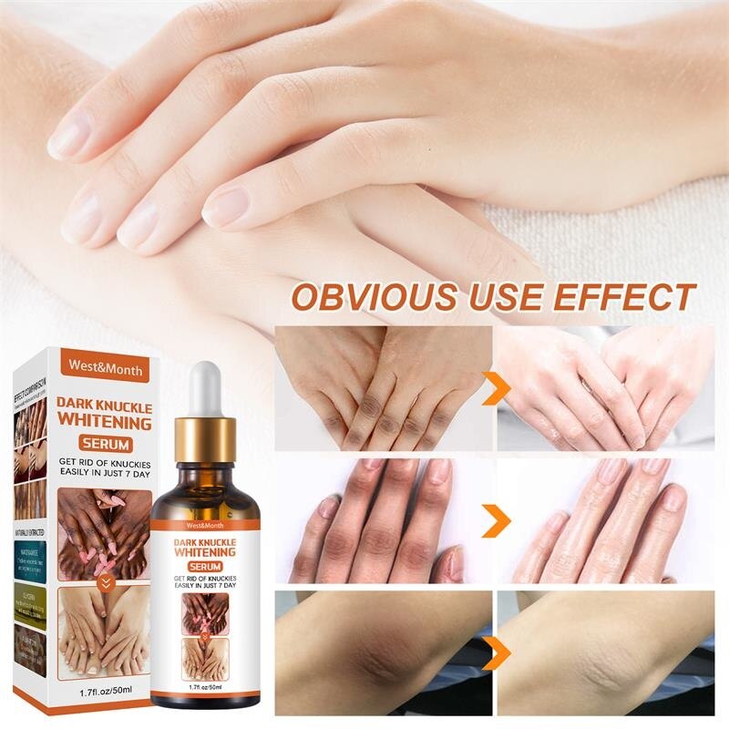 50g Body Whitening Serum Oil Joint De-blackening Lighten Melanin Knee Ankle Corner Brighten Corrector Skin Rejuvenation Bleach - Executive Quality Store