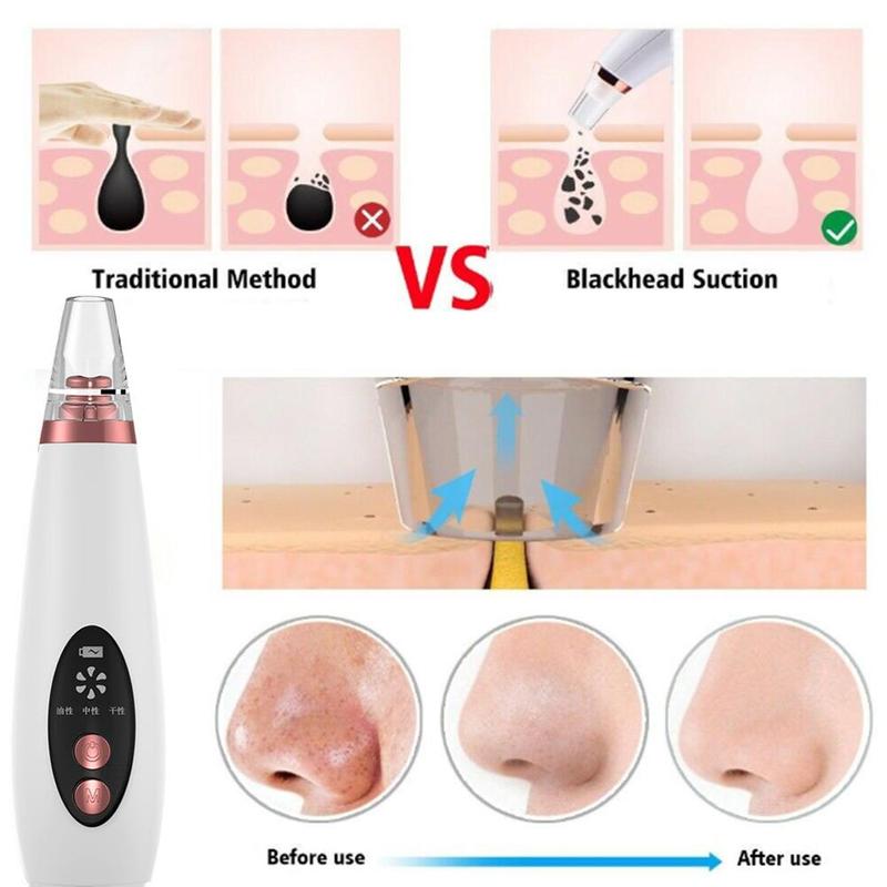 USB Rechargeable Blackhead Remover Face Pore Vacuum Skin Care Acne Pore Cleaner Pimple Removal Vacuum Suction Facial Tools - Executive-Skincare