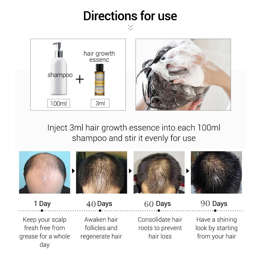 Hair Loss Liquid Hair Growth Serum Oil - Executive-Skincare