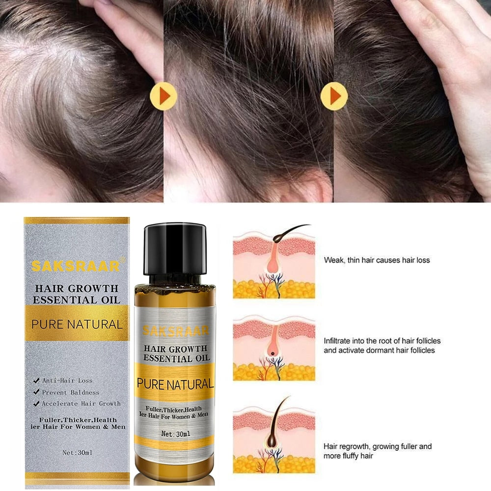 Hair Loss Liquid Hair Growth Serum Oil - Executive-Skincare