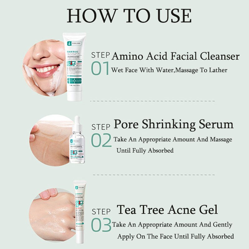 Herbal Acne Removal Face Cream - Executive-Skincare