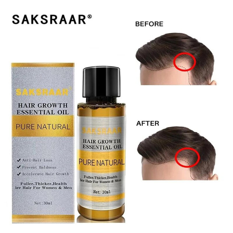 Hair Loss Liquid Hair Growth Serum Oil - Executive-Skincare