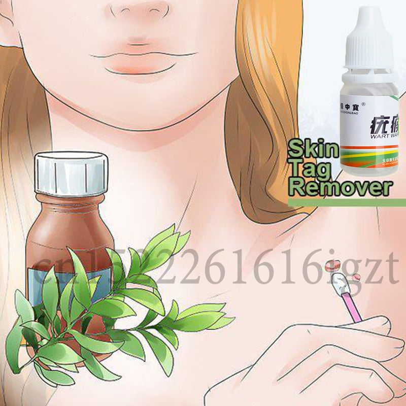 Skin Tag Remover 12 hours Tu kill Medical Tu kill Remover Skin Tag Mole - Executive-Skincare