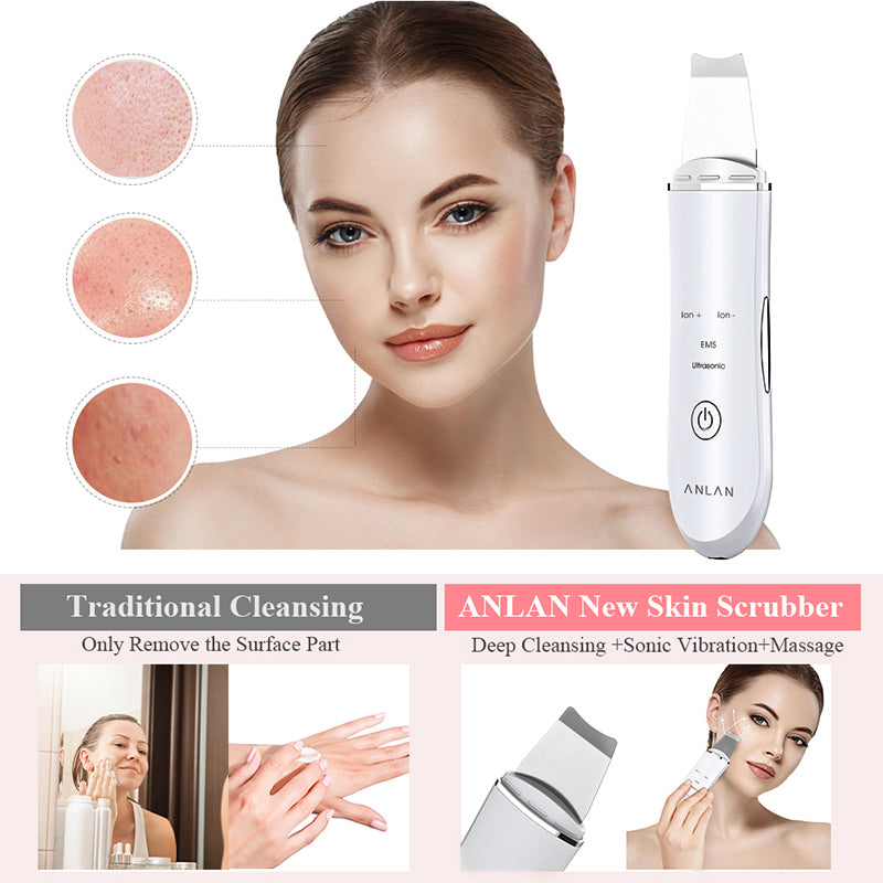 ANLAN ultrasonic SKIN cleanser - Executive-Skincare