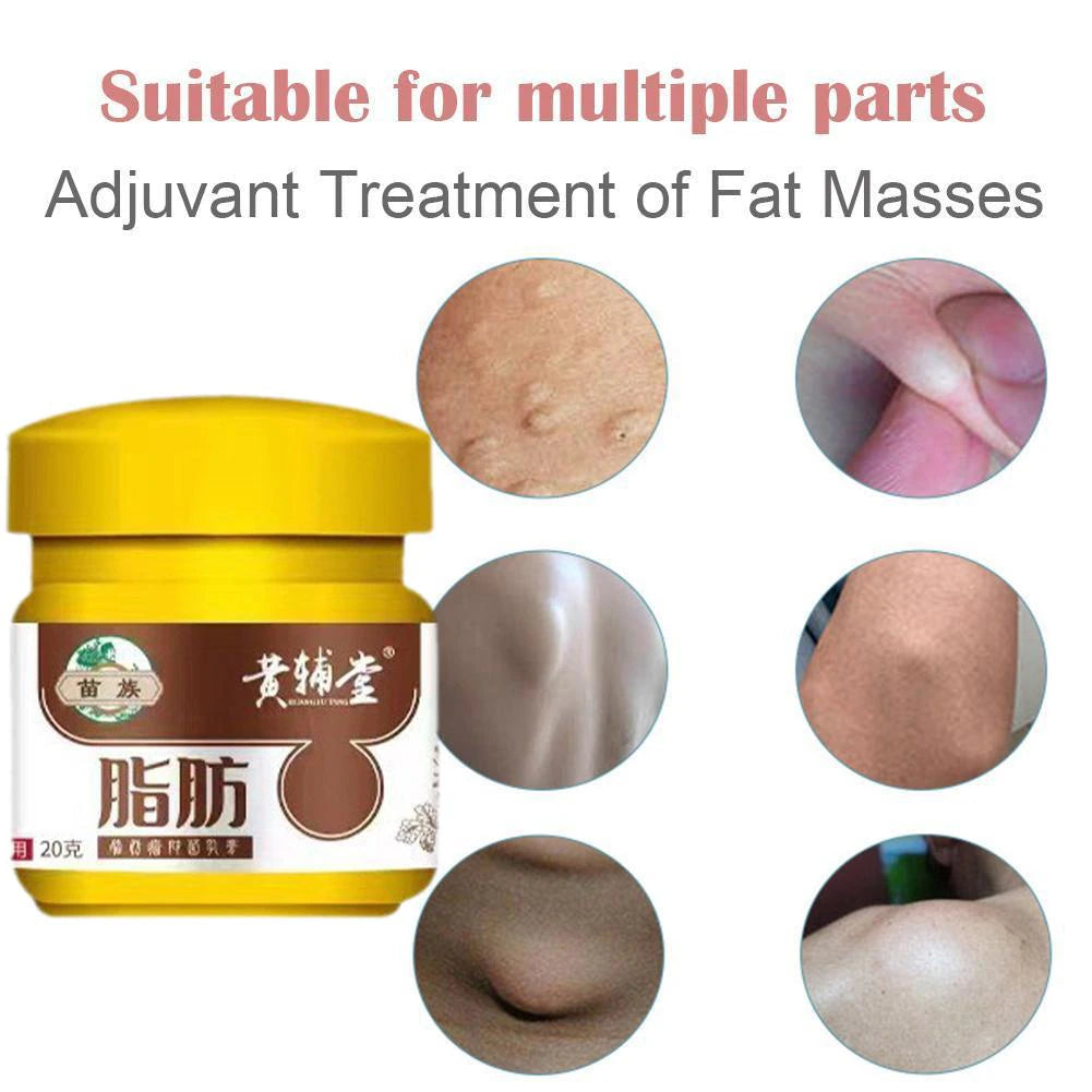 Lipoma Removal Cream 20G Relief Pain Treat Skin Swelling Lipolysis Cellulite Remover Ointment Lipolysis Fat Lump Body Care