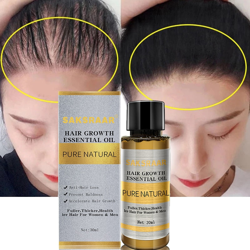 Hair Loss Liquid Hair Growth Serum Oil - Executive-Skincare